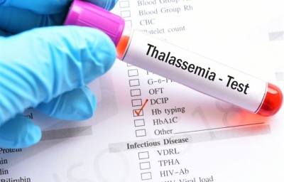 SÀNG LỌC BỆNH THALASSEMIE